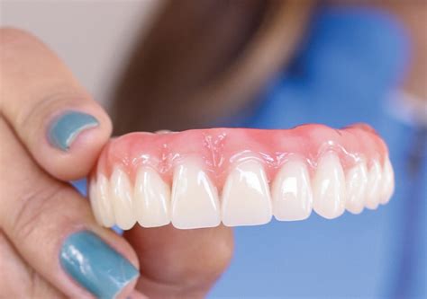 Which Artificial Teeth Is Better
