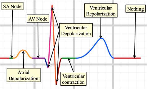 which component of ecg waveform represents ventricular depolarization