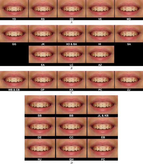 which ethnicities have sharp canines