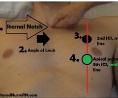 which example is the correct way to record apical pulse quizlet