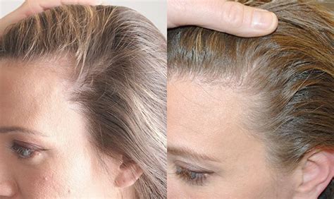  79 Ideas Which Hairstyle Cause Hair Loss For Long Hair