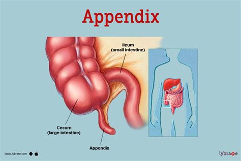 which side is a man's appendix