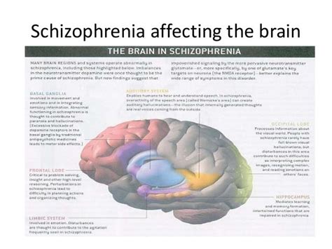which statement is true of brain development and schizophrenia
