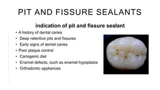 which statement represents an indication for sealants
