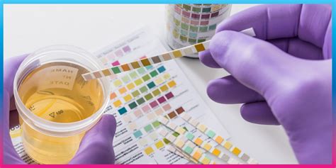 which test is done to detect sugar in urine