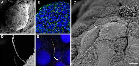 which type of microscope produced the image of cilia