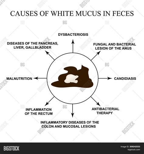 White In Stool Mucus