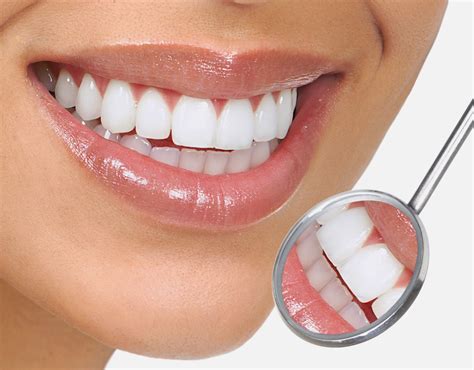 white teeth dental care