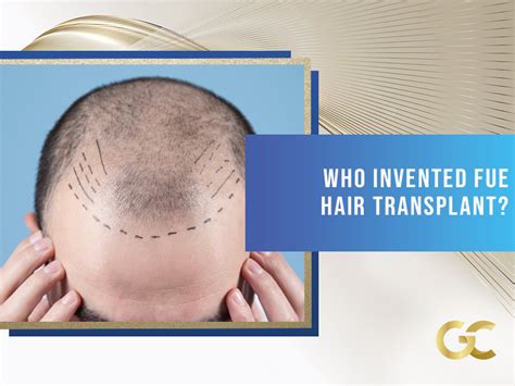who invented fue hair transplant