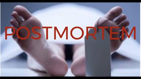 who is involved in a forensic post mortem