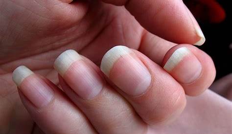 Why Do My Fingernails Look Pink 7 Things That Your Nails Say