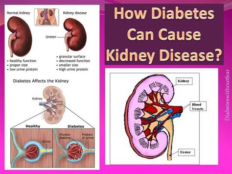 why does diabetes cause kidney failure