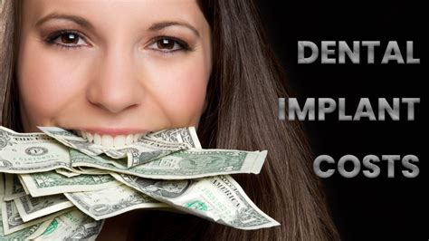 Why is Dental Care in the US So Very Expensive? by Stephen Sovie