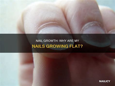 Why Are My Nails Going Flat