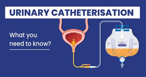 why are patients catheterised