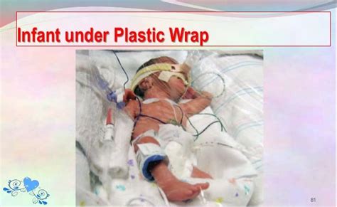 Why Are Preemies Wrapped In Plastic