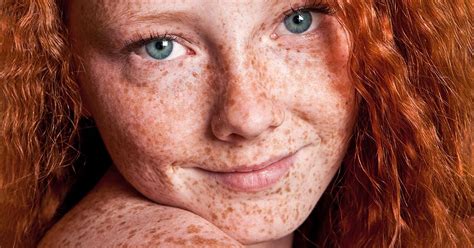 Why Are Redheads Unique 