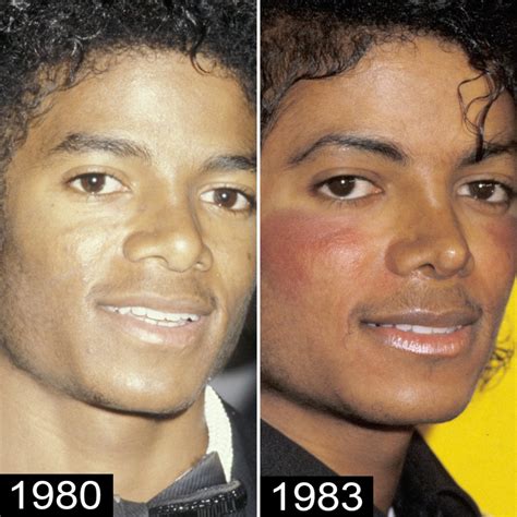 why did mj change his nose