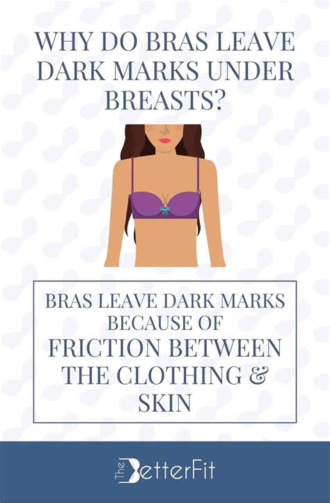 Why Do Bras Leave Marks
