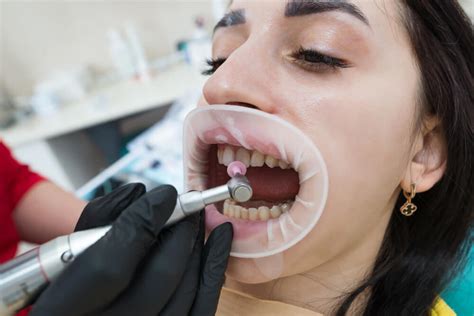 Why Do Dentists take Dental XRays?