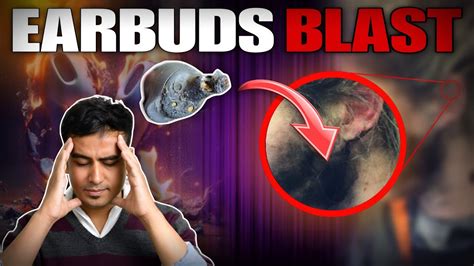 why do earbuds explode