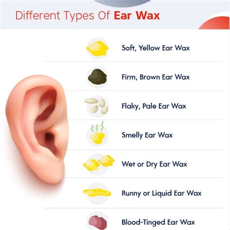What Does Your Earwax Tell About Your Health Buzz Health Tips 