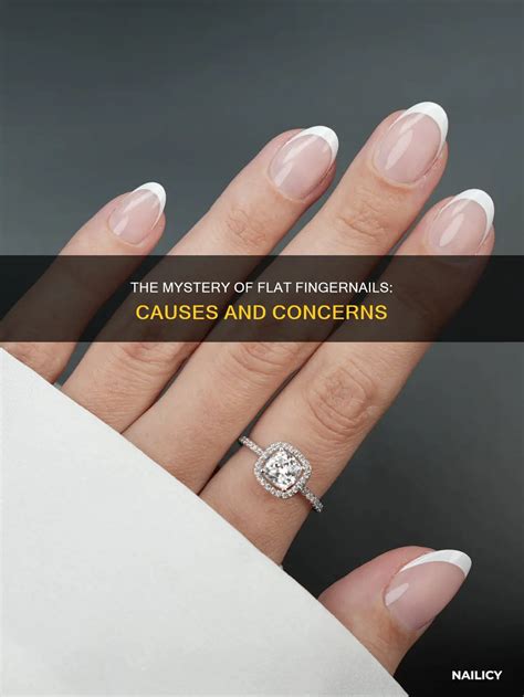 Why Do I Have Flat Nails