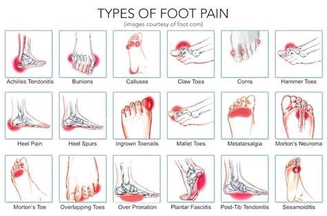 Understanding Why Do My Feet Ache Every Day