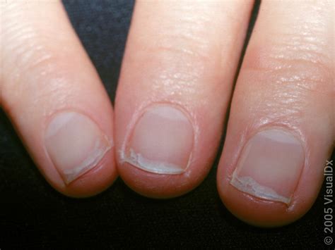 Why Do Nails Split
