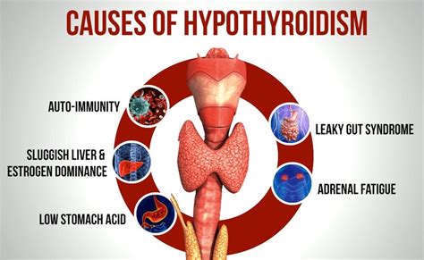 why does hypothyroidism cause fluid retention