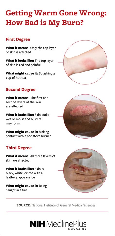 Why Does It Burn When I Get Wet