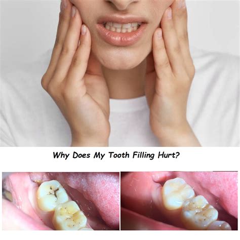 Why Does My Filling Hurt