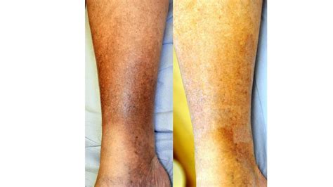 Why Does My Skin Stain Sheets