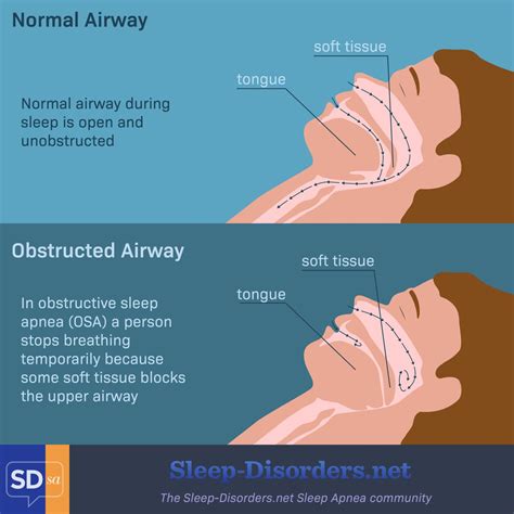 why does sleep apnea cause headaches