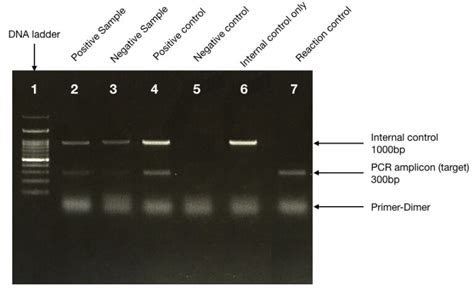 why is a negative control essential in a pcr experiment