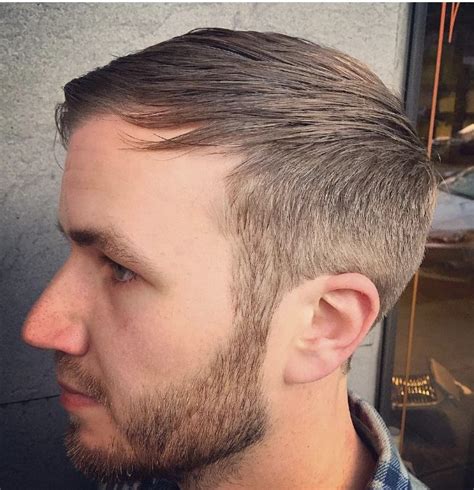 Why Is My Hair Thinning Out On The Sides 