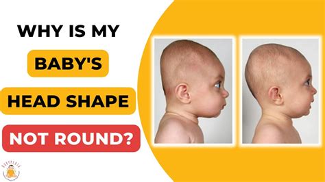 Why Is My Head Squeezing