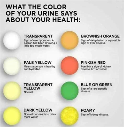 why is my pee neon green after taking vitamins