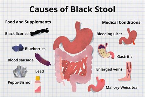 Why Is My Poop Suddenly Darker