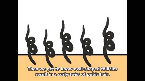 Why Is My Pubic Hair Curly 