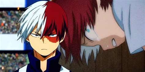 Why Is Todoroki Burned