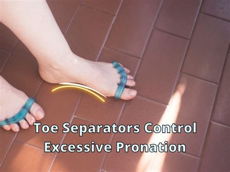 Why Use Toe Separators