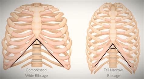 wide rib cage vs normal