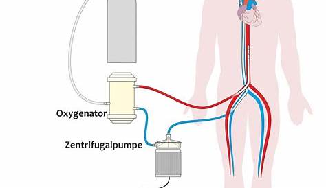 Herz - Lungen Maschine die das Herz & Lunge Funktionen des Patienten