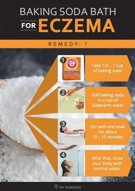 Will Baking Soda Help Eczema