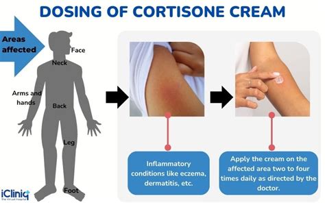 Will Cortisone Help Ringworm