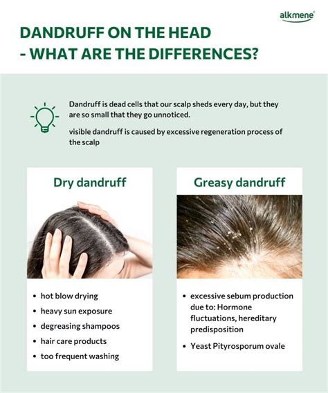 Will Dry Shampoo Cause Dandruff