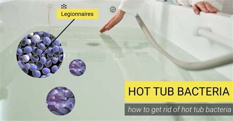 Will Shocking A Hot Tub Kill Bacteria