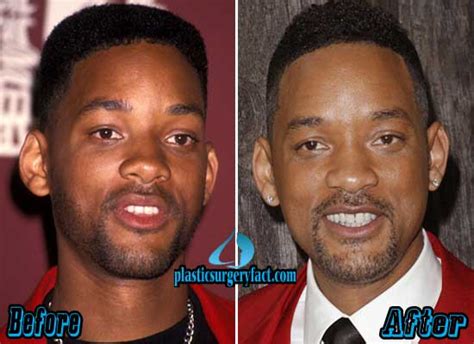 will smith before and after