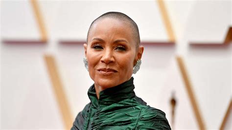 will smith wife alopecia